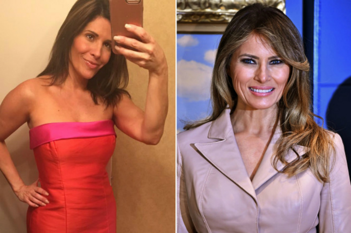 Melania Trump cirugía plástica