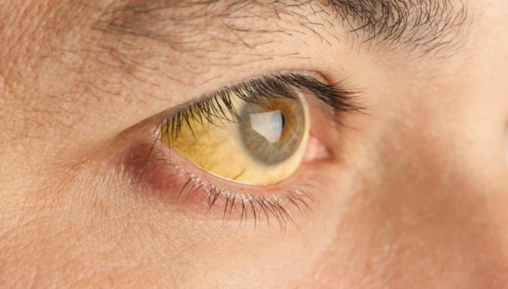 Una app permite detecta cáncer de páncreas al tomarte una selfie
