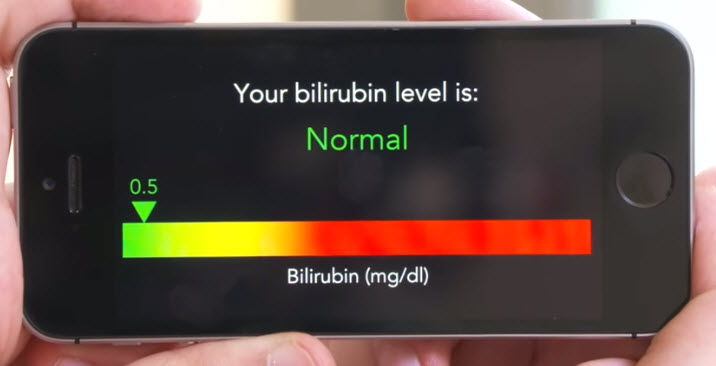 Una app permite detecta cáncer de páncreas al tomarte una selfie