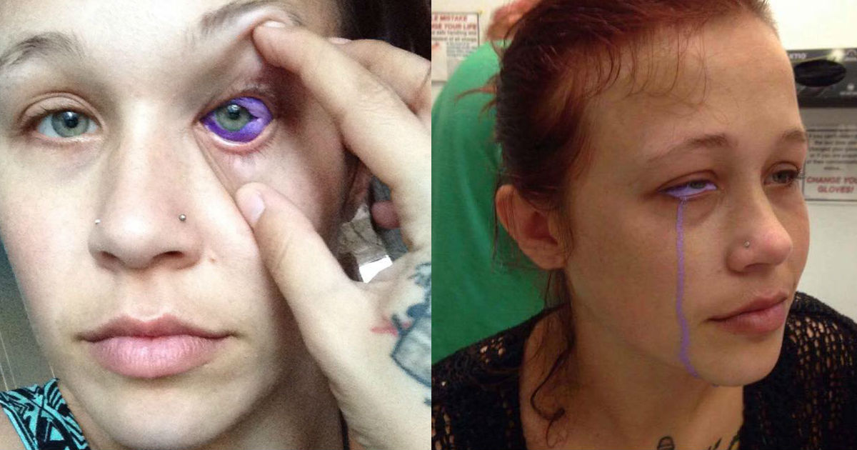 El tatuaje de ojo infectado de Catt Gallinger