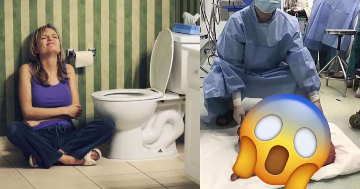 Le extirparon 13 kilos de materia fecal