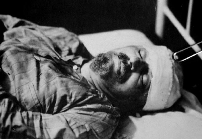 Trotsky_Herido