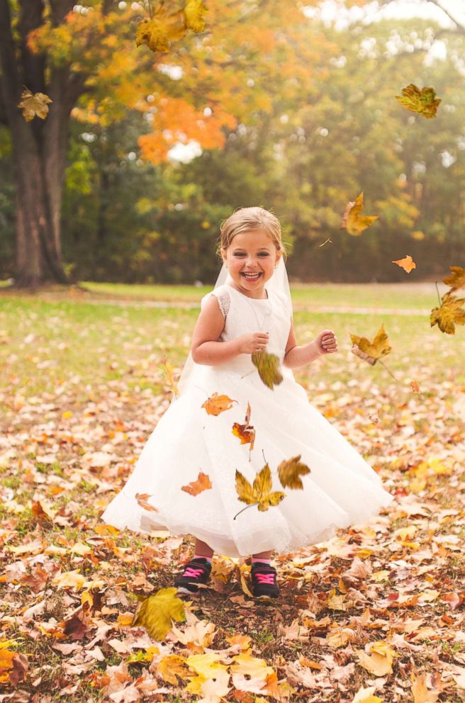 Operación a Corazón Abierto, Niñita, Boda, Cirugía, Princesa, Fotos