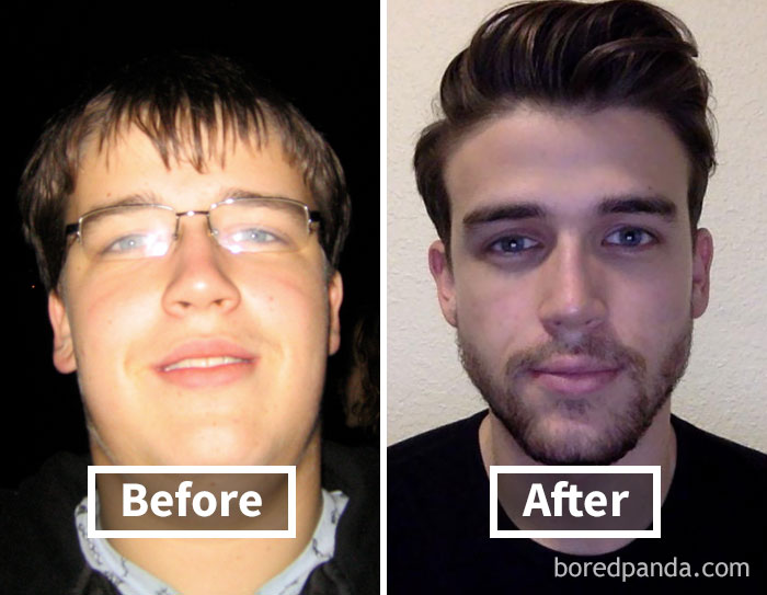 [Image: before-after-weight-loss-face-transforma...7__700.jpg]