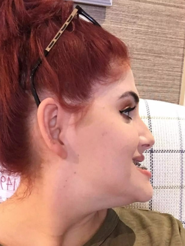 sophie-rose-mandibula-3