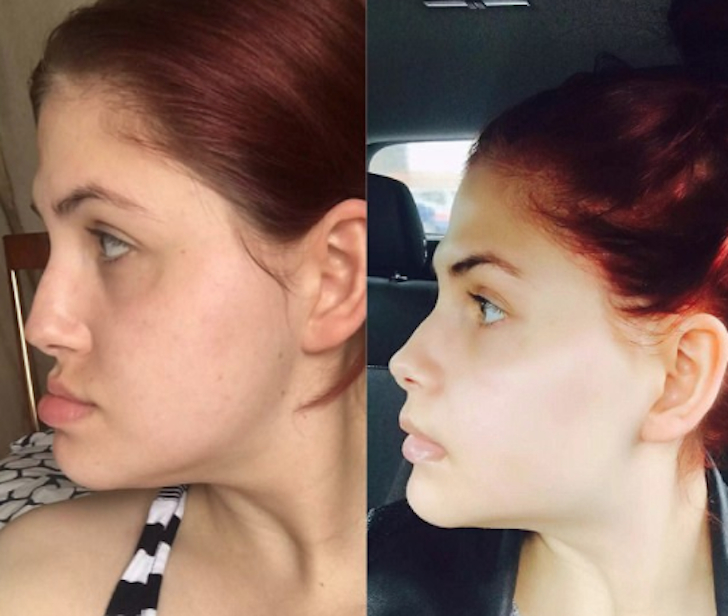 sophie-rose-mandibula-5