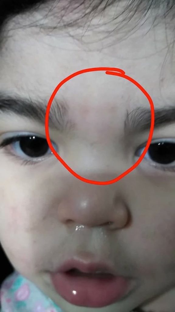 Madre enfurecida porque alguien depiló las cejas de su hija en guardería