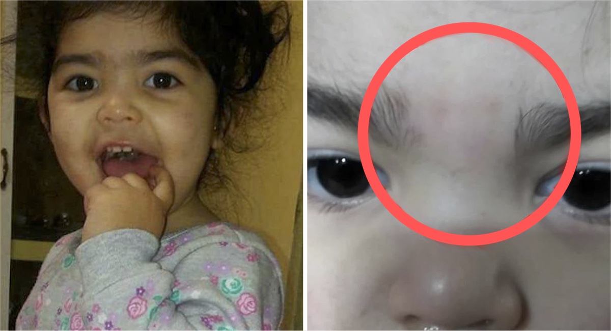 Madre enfurece porque depilaron cejas de su hija en guarderÃ­a
