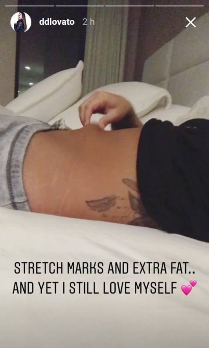 demi-lovato-presume-estrias-poderoso-mensaje-cuerpo-humano