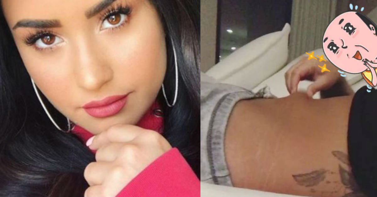 demi-lovato-presume-estrias-poderoso-mensaje-cuerpo-humano