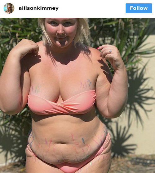 Bodyshaming Mujeres Físico Cuerpo Chicas Peso