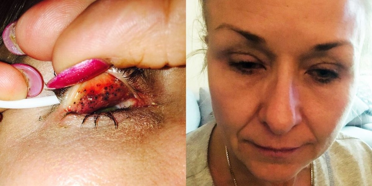 Desmaquillar Diario Pasarte Maquillaje Ojos InfecciÃ³n Ceguera