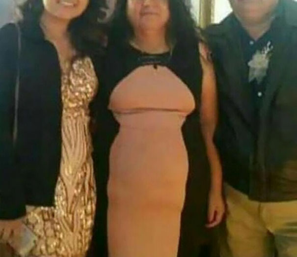 Vestidos-horribles