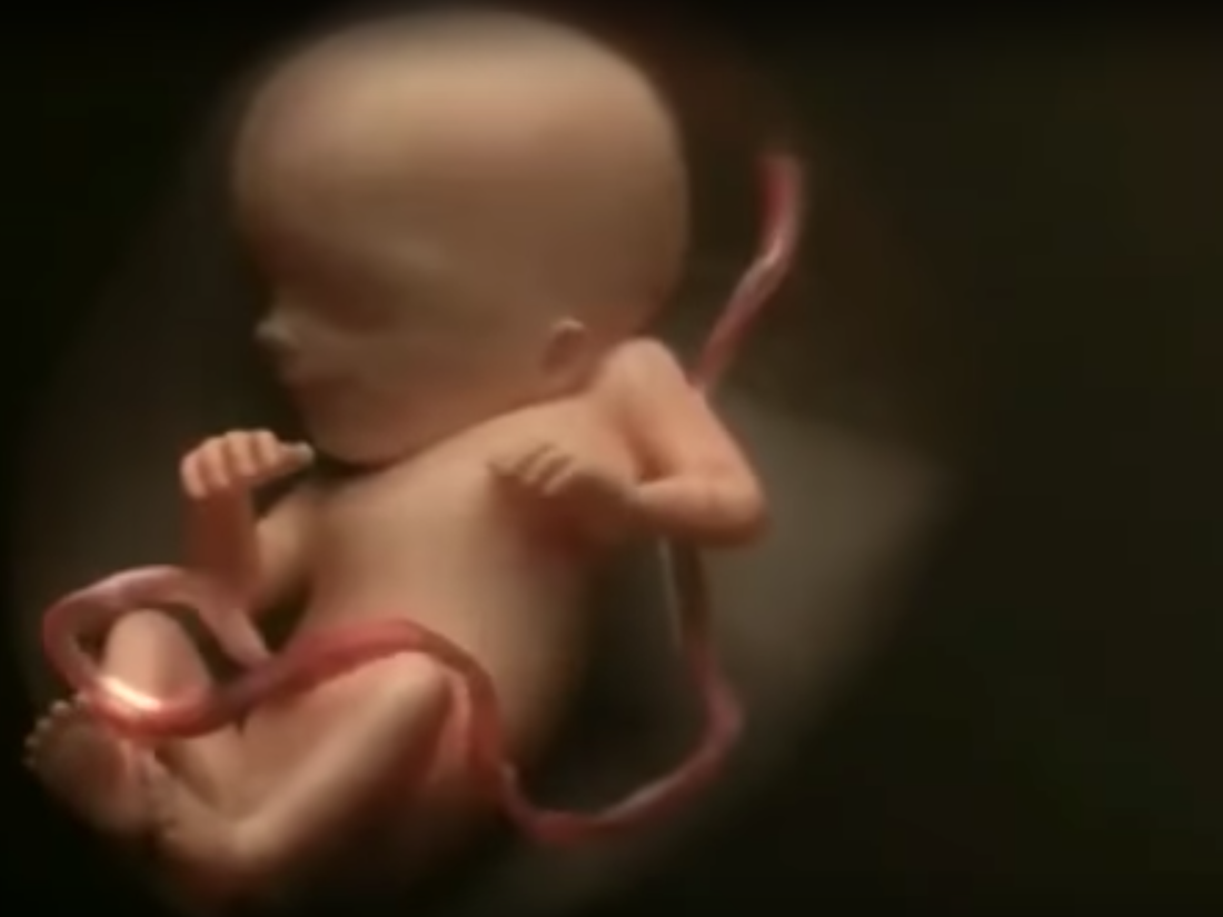 Fetos Embriones Aborto Exposición Museo Chile