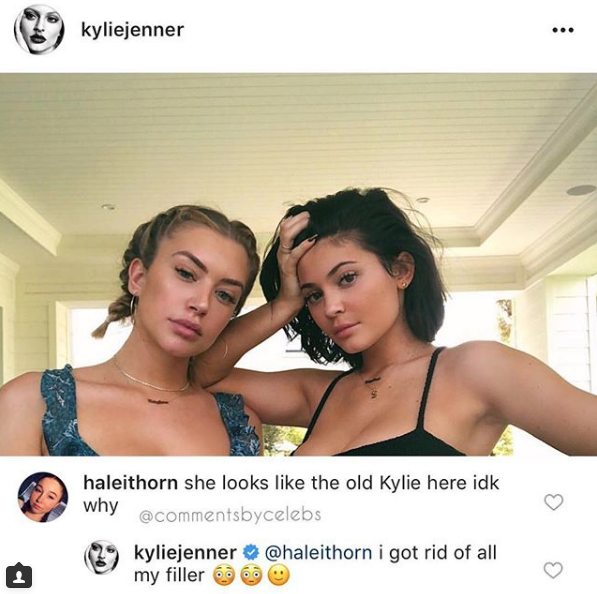 Kylie Jenner se quita relleno labios