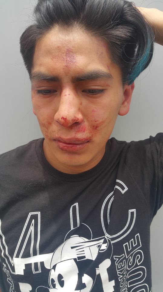 Intentan frustrar secuestro y le dan golpiza