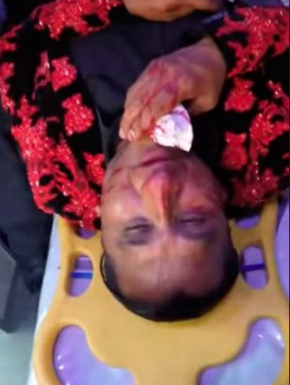 Lady Wuu terminó en el hospital por culpa del Rey Grupero