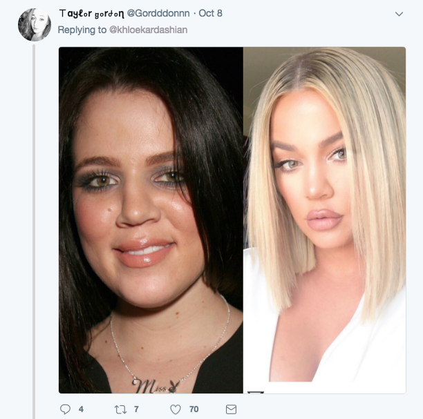Khloe Kardashian niega cirugÃ­as plasticas