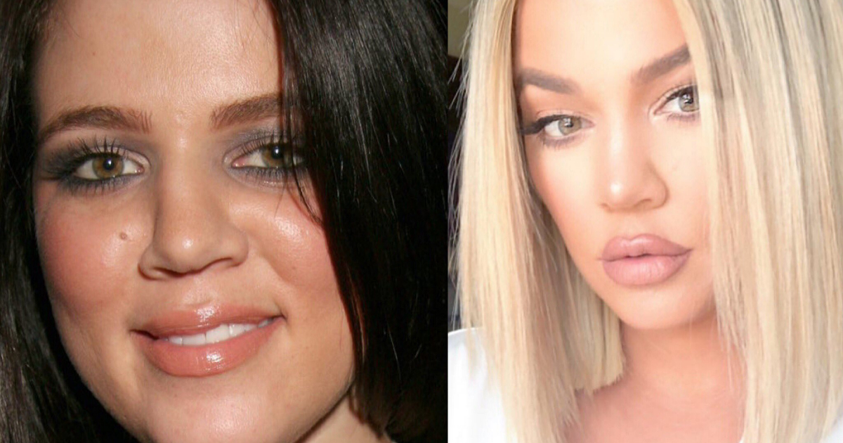 KhloÃ© Kardashian Niega CirugÃ­as PlÃ¡sticas, KhloÃ© Kardashian CirugÃ­as PlÃ¡sticas, KhloÃ© Kardashian, CirugÃ­a PlÃ¡stica, Antes DespuÃ©s KhloÃ© Kardashian, Kardashians