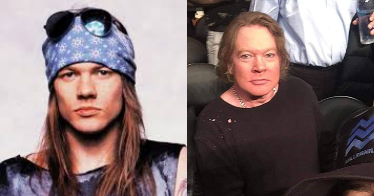Axl Rose sorprende con cirugÃ­as plÃ¡sticas