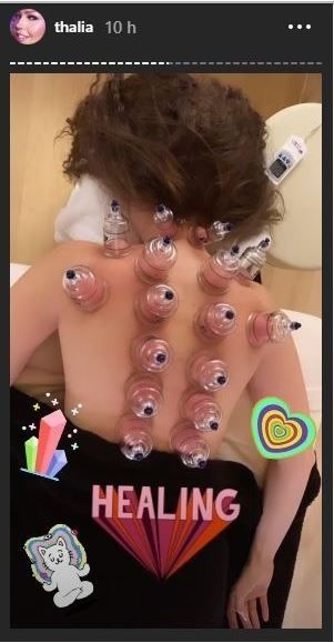 ThalÃ­a sube fotos desnudas con su cupping therapy