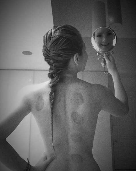 ThalÃ­a sube fotos desnudas con su cupping therapy