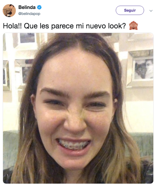 Belinda se pone brackets y desata memes y comentarios