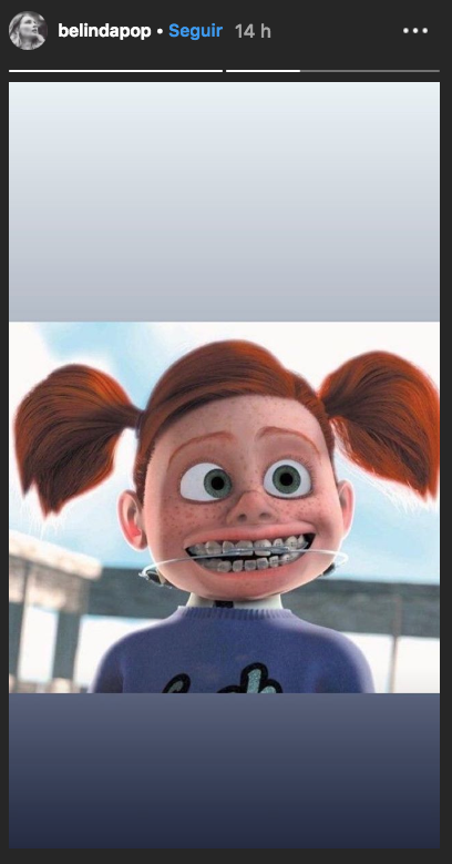 Belinda se pone brackets y desata memes y comentarios