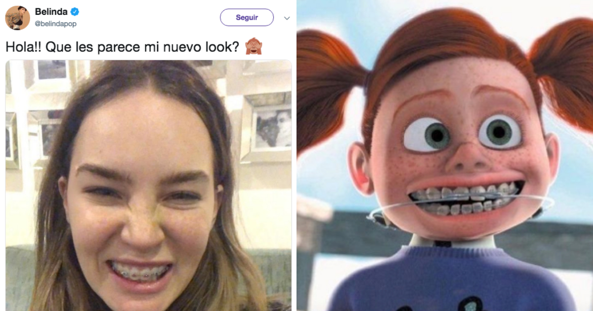 Belinda Se Pone Brackets, Belinda Con Brackets, Brackets, Belinda, Memes, Dientes