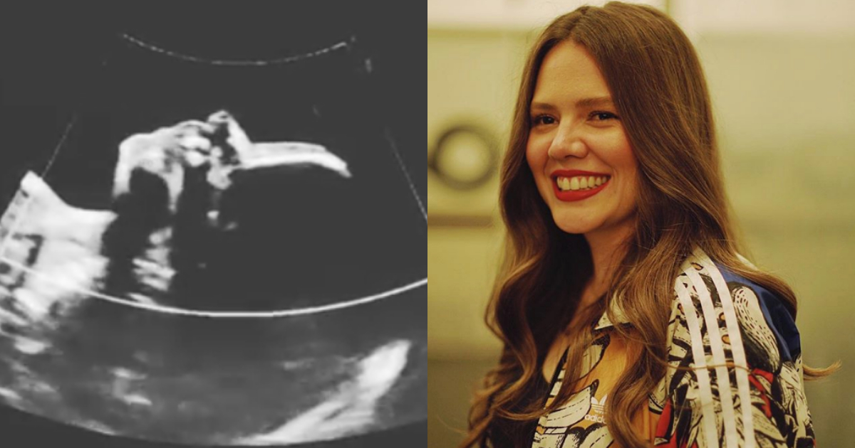 Esposa De Joy, Joy Huerta, Joy Jesse Joy, BebÃ© Joy Huerta, Joy Esposa, Joy Jesse Y Joy