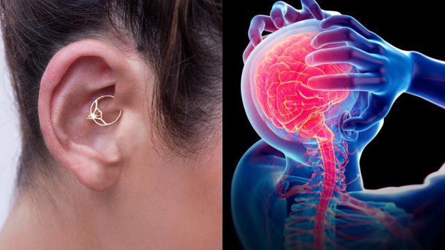 Daith Piercing, Beneficios Daith Piercing, Migraña, Piercing Para Migraña, Daith Piercing Duele, Daith Piercing Migraña