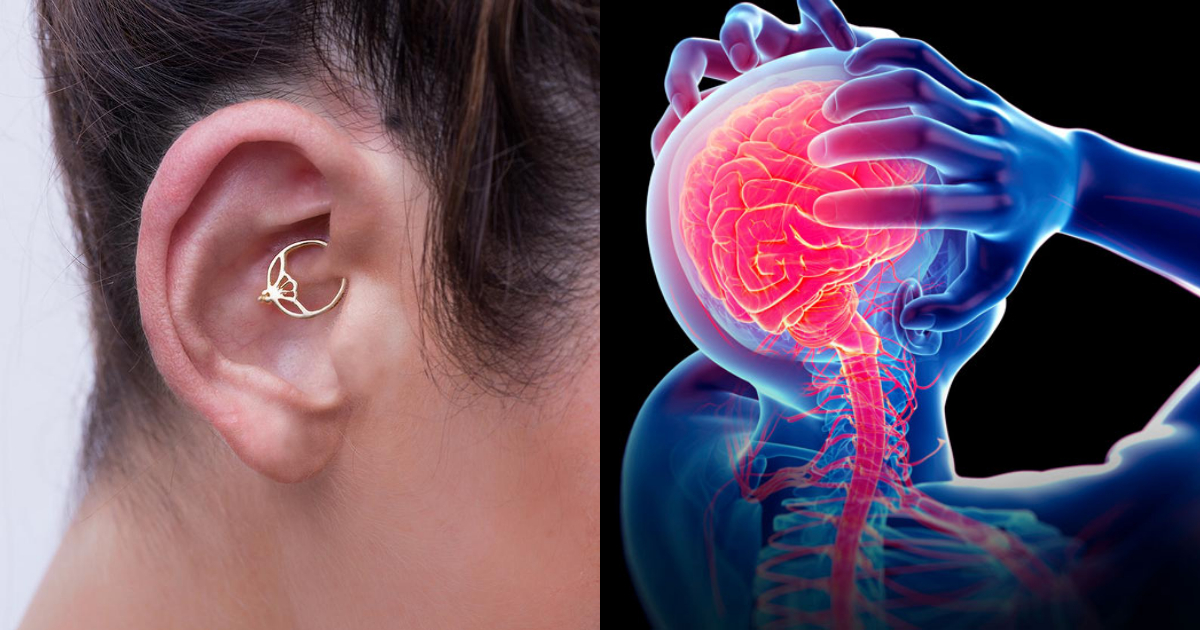 Daith Piercing, Beneficios Daith Piercing, Migraña, Piercing Para Migraña, Daith Piercing Duele, Daith Piercing Migraña