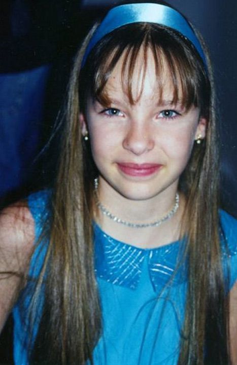 Antes y después: cómo ha cambiado Belinda con las cirugías