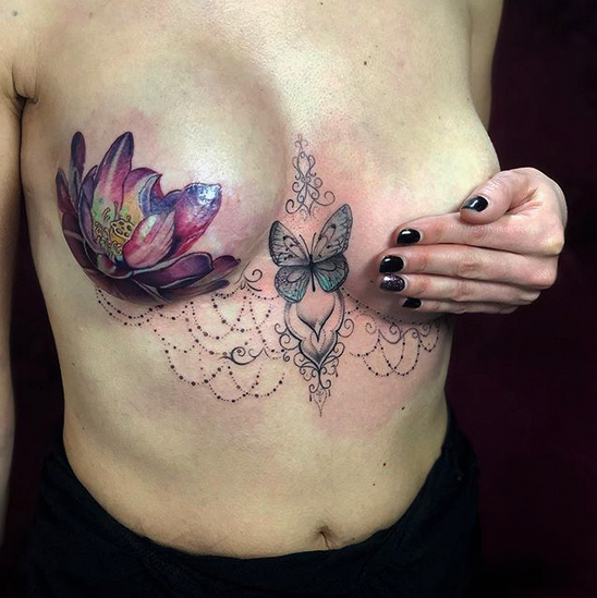 Tatuajes ayudan a mujeres a superar el cáncer de mama