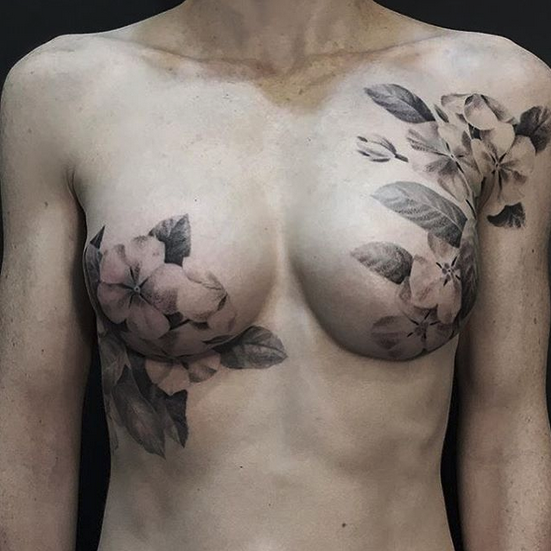 Tatuajes ayudan a mujeres a superar el cáncer de mama