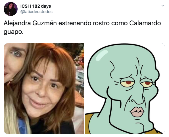 Preocupa rostro de Alejandra Guzmán tras última cirugía plástica