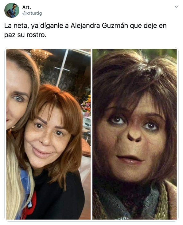 Preocupa rostro de Alejandra Guzmán tras última cirugía plástica