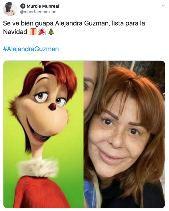 Preocupa rostro de Alejandra Guzmán tras última cirugía plástica