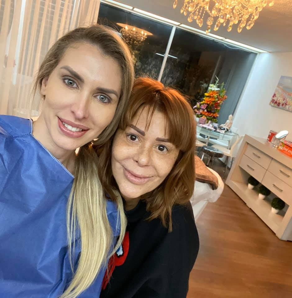 Preocupa rostro de Alejandra Guzmán tras última cirugía plástica