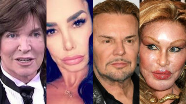 11 famosos cuyas cirugÃ­as plÃ¡sticas salieron peor que ninguna otra