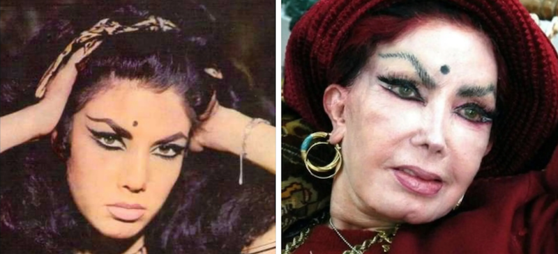 Famosos a los que la cirugía plástica les salio mal