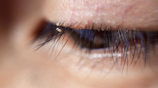 Alertan por piojos en extensiones para pestaÃ±as