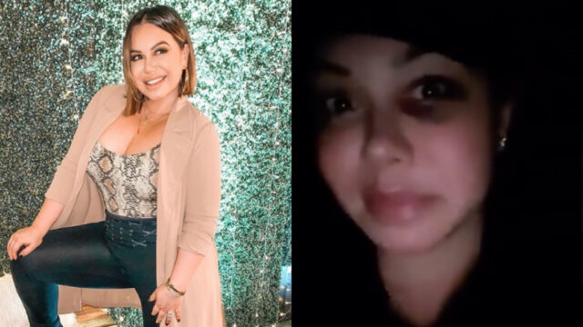 Chiquis Rivera aclara por qué tiene ojo morado ¿violencia?