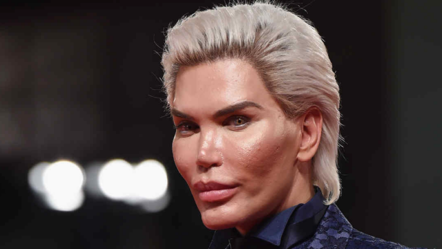 Ken Humano, Rodrigo Alves, ahora es una mujer transgÃ©nero
