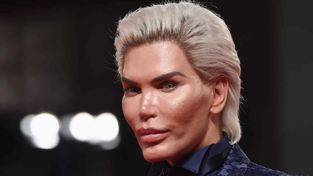 Ken Humano, Rodrigo Alves, ahora es una mujer transgénero
