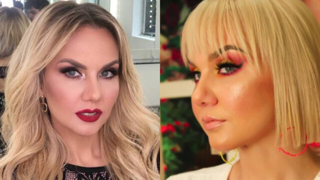 Michelle Vieth: mensaje en redes tras aparecer con moretones