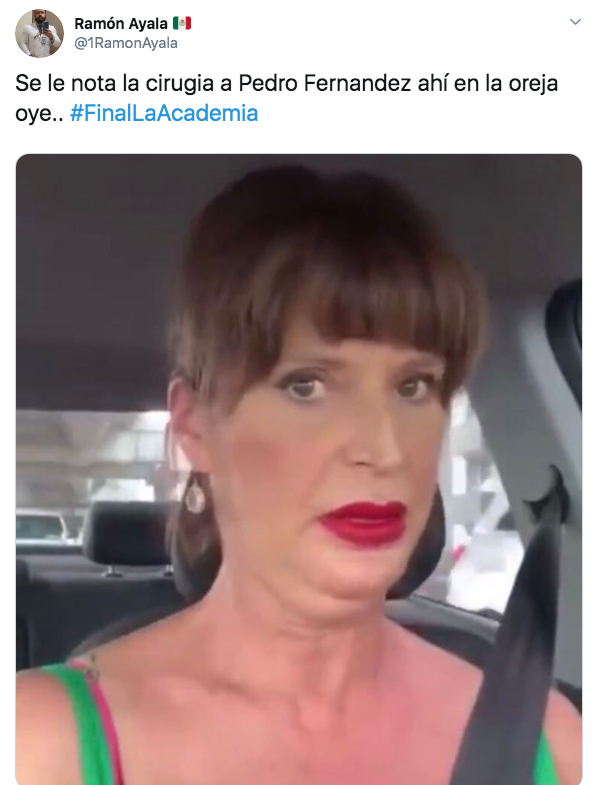 Critican rostro de Pedro Fernández por supuesto bótox