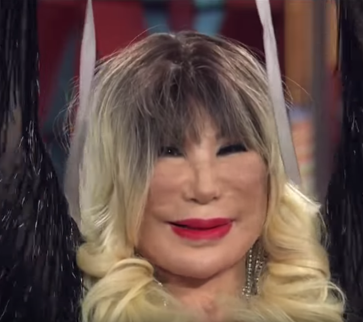 Lyn May revela su nuevo rostro tras cirugía número 100