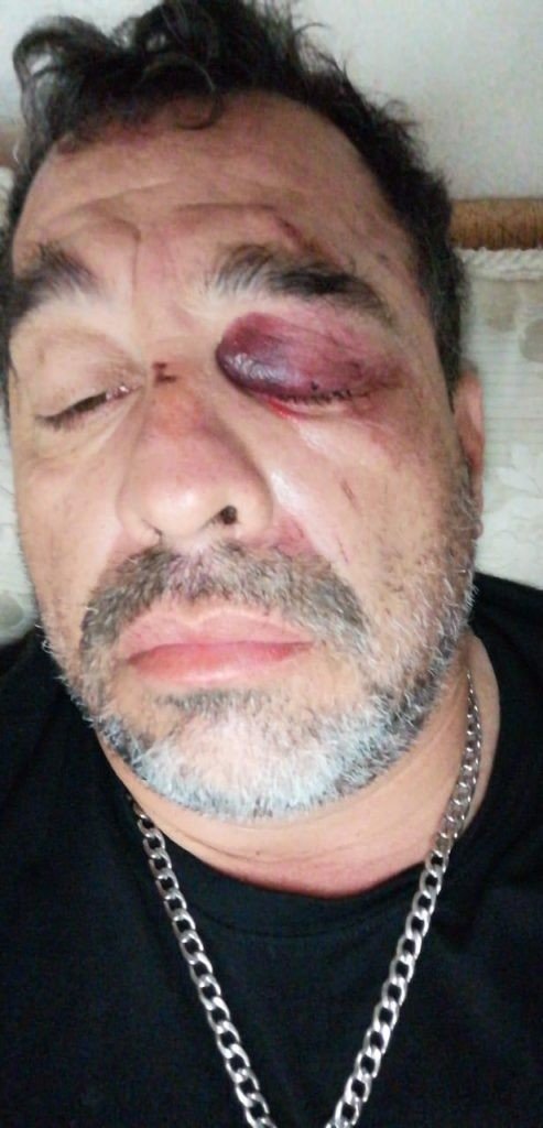 'El Borrego' Nava sufrió un accidente en su motocicleta