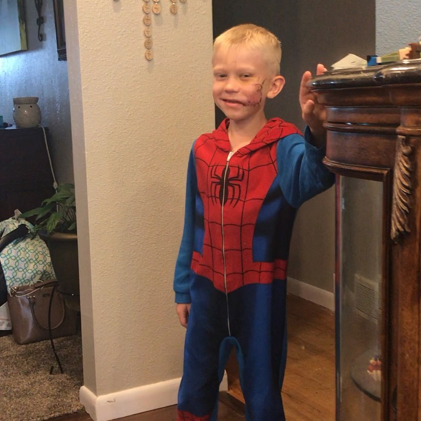 Avengers reconocen como héroe al niño que salvó a su hermana de un perro